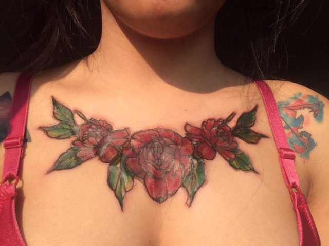 La terribles consecuencias que dejó en una adolescente quitarse un tatuaje con técnica Rejuvi